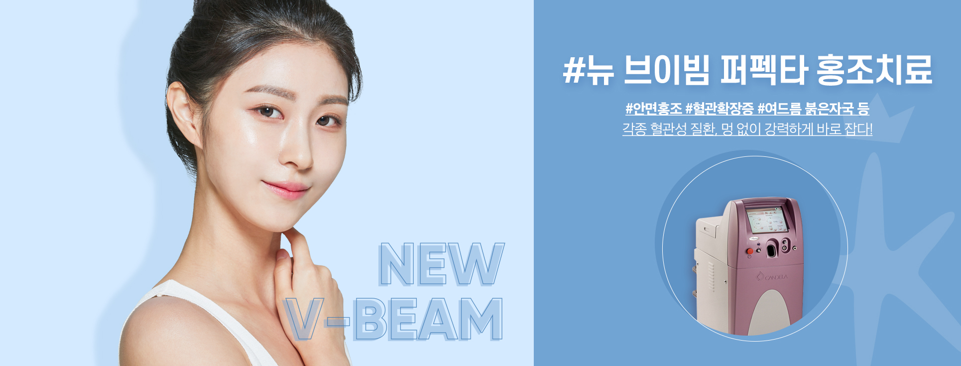 V빔 퍼펙타(V Beam Perfecta) 레이저 출시 8